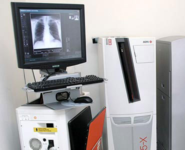 radiologia contrastada com método digital